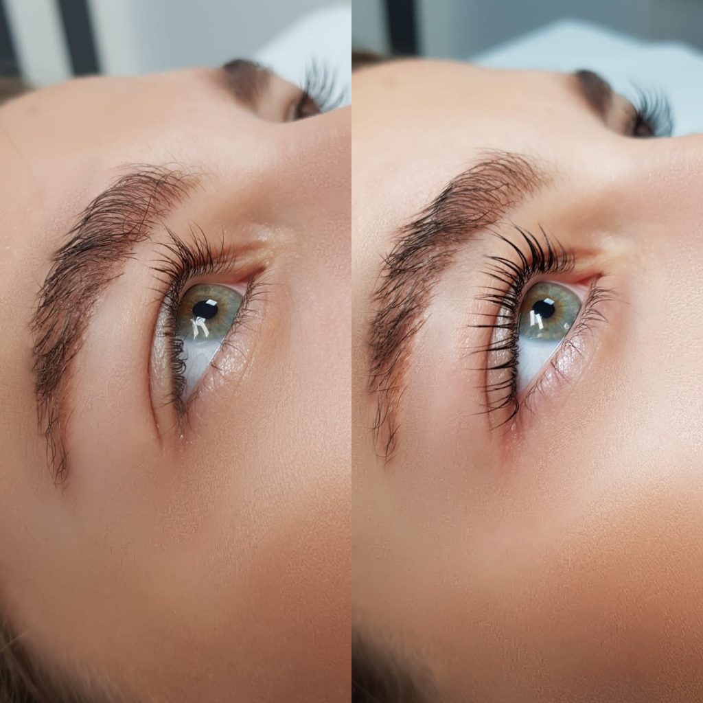 Laminare gene cu deplasare la domiciliu la doar 350 sau laminare gene